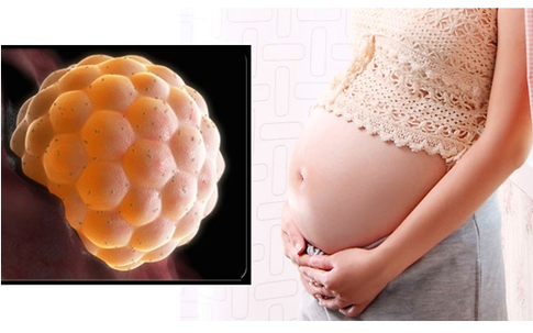 Người phụ nữ 49 tuổi tưởng tiền mãn kinh, bất ngờ phát hiện chửa trứng từ dấu hiệu nhiều chị em dễ bỏ qua