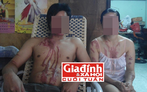 Ca hóa chất xé nát giấc mơ lập nghiệp của đôi vợ chồng nghèo 