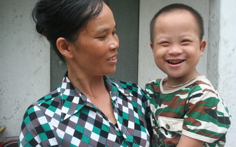 Bé 5 tuổi mồ côi hồn nhiên chơi đùa sau 4 lần phẫu thuật