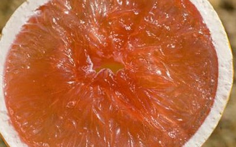 Những thực phẩm đơn giản chống ung thư gan