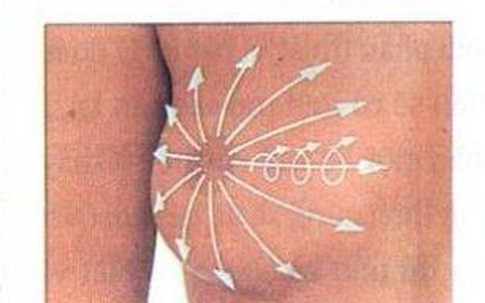 Các bước tự khám ngực để phát hiện ung thư