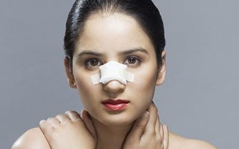 Nâng mũi bằng silicon, cứ ăn thịt bò là sưng thâm