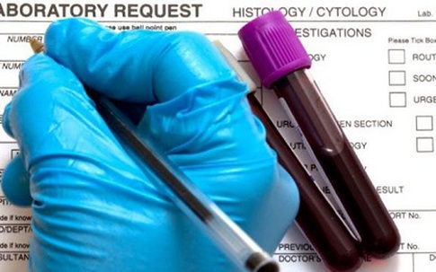 Ung thư vòm họng gia tăng đột biến do... "yêu" bằng miệng