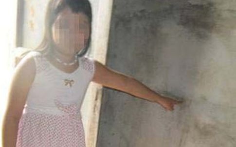 Trưởng thôn dâm ô, làm bầm tím "vùng kín" bé gái 9 tuổi