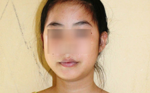 Thiếu nữ 15 tuổi dụ đàn ông đến "cứu nét" để cướp
