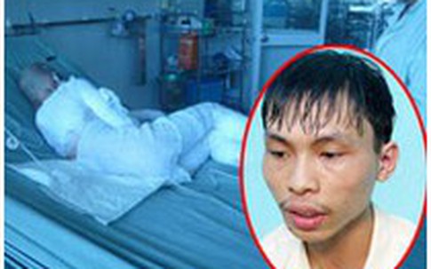 Giáp mặt gã trai hắt cả xô axit đậm đặc vào gia đình ông chủ