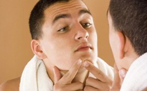 Mụn trứng cá: Nam giới đừng chủ quan!