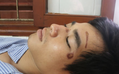 Công an xã Liên Am (Vĩnh Bảo) đánh dân
