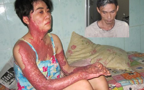 Vụ chồng tạt xăng đốt vợ vì máu đỏ đen: Tâm sự đắng lòng của người vợ