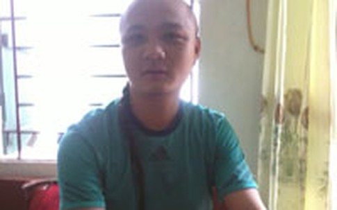 Căn bệnh kỳ lạ khiến người đàn ông cả đời không dám cắt tóc