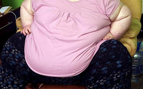 Cô gái 19 tuổi có cân nặng 300 kg