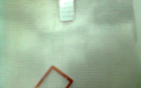 Bất cẩn, bé 2 tuổi nuốt khung sim điện thoại vào thực quản