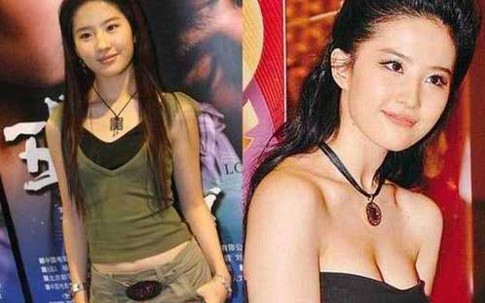 Những mỹ nhân "lên đời" nhờ dao kéo vòng một