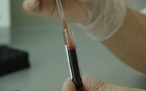 4 lý do bạn nên biết nhóm máu của mình