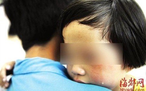 Bé gái 5 tuổi mắc bệnh lậu sau khi bị lạm dụng tình dục