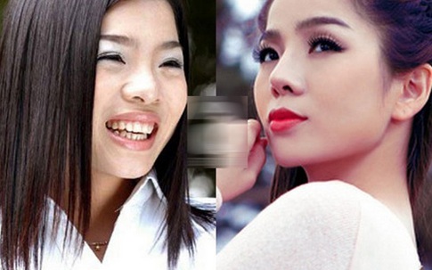 Kiều nữ Việt đẹp nhờ sửa mũi