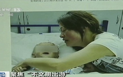 Kinh hoàng bé 8 tháng tuổi thay bỉm tại công viên, bị khỉ ăn mất tinh hoàn