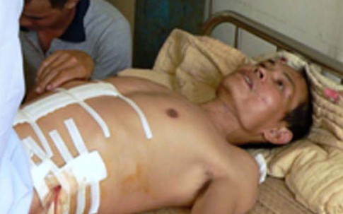 Bị nghịch tử đâm, bố vẫn giấu tội cho con: Tình thương đặt nhầm chỗ