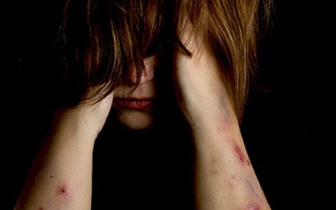 Bé gái 10 tuổi tấn công tình dục bé trai 4 tuổi