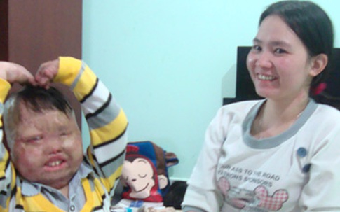 Hành trình tìm lại tuổi thơ của cậu bé bị cha đốt