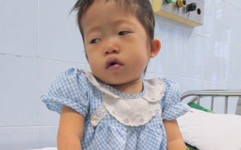 Bé 3 tuổi từng bị bỏ rơi tím tái không thể phẫu thuật được