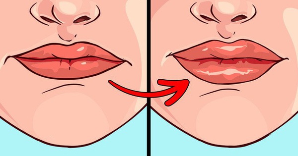 Cứ thấy xuất hiện 8 dấu hiệu này ở môi thì đừng chần chờ mà hãy đi khám gấp, đặc biệt là khi môi nhợt nhạt hoặc có đốm đen