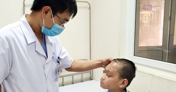 Bé 8 tuổi bị dập não sau cú ngã đập đầu khi đi xe máy với mẹ