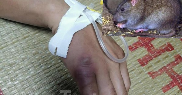 Suýt mất mạng vì sốt hạch nghi chuột rừng cắn