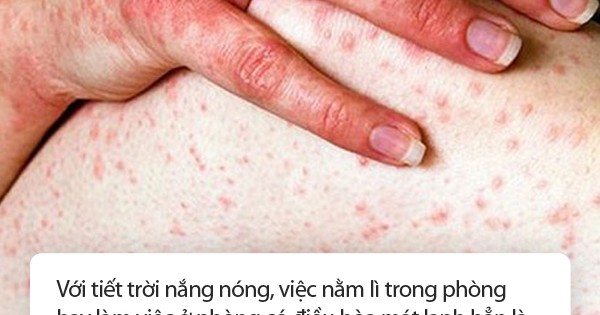 Chuyên gia cảnh báo ai đang dùng điều hòa kiểu này hãy thay đổi ngay, nếu không rất dễ mắc bệnh, đột quỵ lúc nào không hay - Vimarsana News