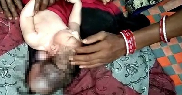 Bé sơ sinh ba đầu được dân làng tôn là 'hiện thân của thần linh' - Vimarsana News