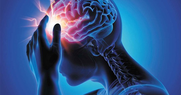 Chàng trai 31 tuổi chết vì nhồi máu não, nguyên nhân nhiều bạn trẻ mắc - Vimarsana News
