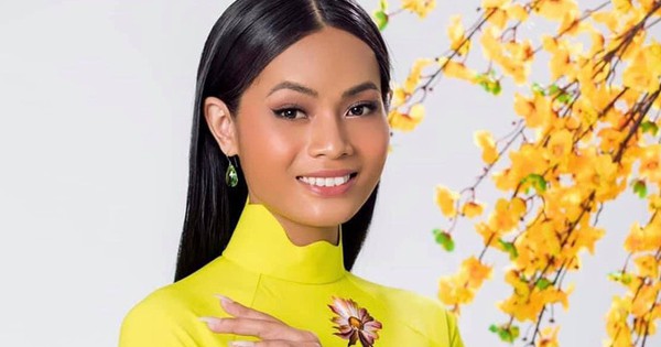 Người mẫu Châu Kim Sang bị viêm màng não, ung thư xương di căn khiến loạt sao Việt xót xa - Vimarsana News