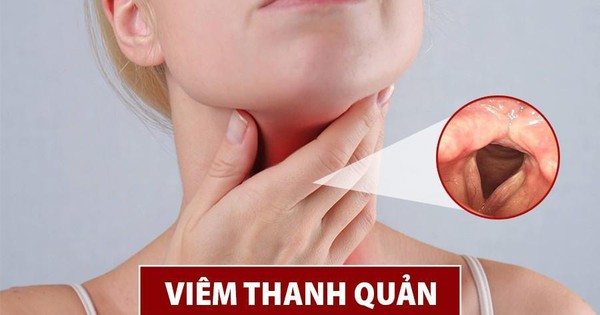 Cải thiện viêm thanh quản hiệu quả, an toàn nhờ sản phẩm thảo dược - Vimarsana News