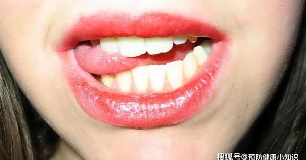 Cô gái 24 tuổi bị nhồi máu não trong đêm khuya, BS cảnh báo thói quen sau khi quan hệ tình dục có thể gây hại sức khỏe - Vimarsana News
