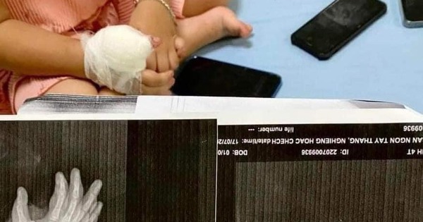 Thanh Hoá: Nổ súng tại quán Karaoke, một cháu bé 4 tuổi bị đạn găm vào tay