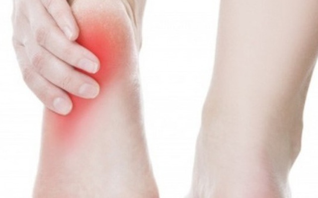 Đau gót chân vì sao?