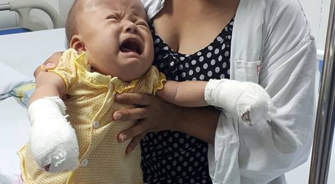 Tiếng khóc xé lòng của bé 17 tháng tuổi bị dị dạng