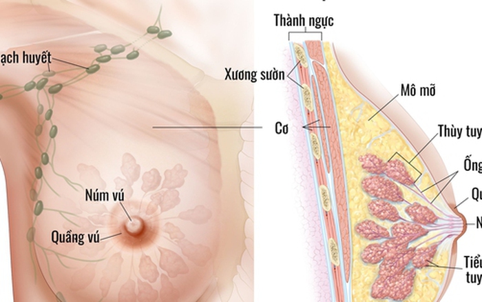 Ung thư vú: Các dấu hiệu nhận biết sớm