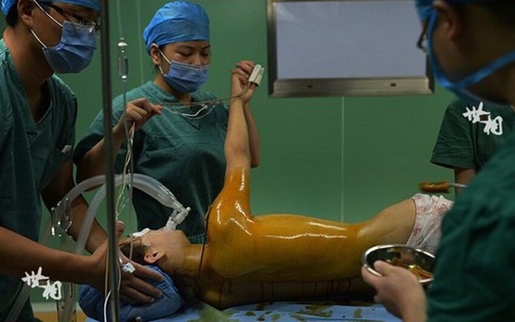 CẬN CẢNH QUY TRÌNH PHẪU THUẬT NÂNG NGỰC NỘI SOI ĐƯỢC THỰC HIỆN CHUYÊN NGHIỆP CHUẨN Y KHOA