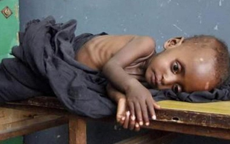 Xót xa hình ảnh những đứa trẻ châu Phi gầy trơ xương vì đói