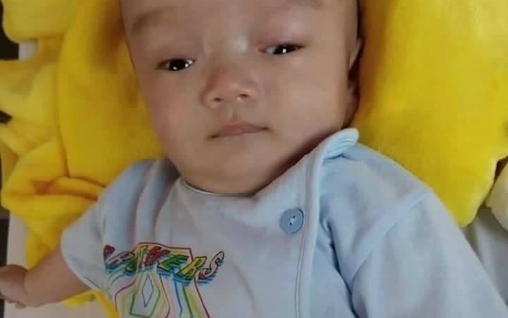 Rớt nước mắt hình ảnh bé trai 3 tháng tuổi bị não úng thủy