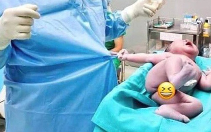 Bé sơ sinh vừa chào đời kéo áo "ăn vạ" bác sĩ