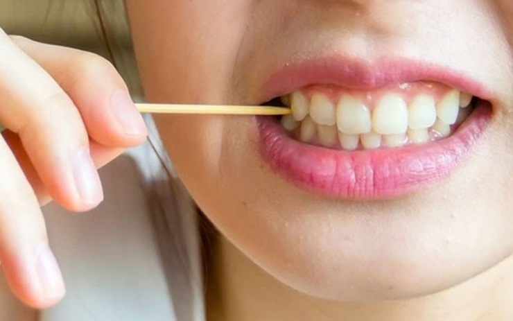 Các yếu tố gây tụt lợi chân răng