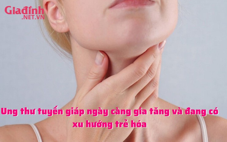 Ung thư tuyến giáp ngày càng gia tăng và đang có xu hướng trẻ hóa
