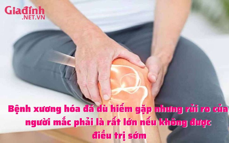 Bệnh xương hóa đá dù hiếm gặp nhưng rủi ro của người mắc phải là rất lớn nếu không được điều trị sớm