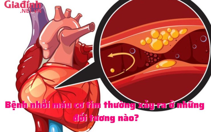 Bệnh nhồi máu cơ tim thường xảy ra ở những đối tương nào?