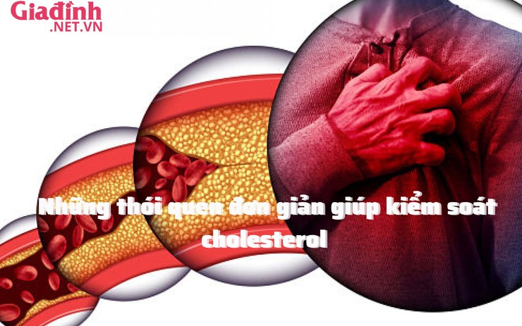 Những thói quen đơn giản giúp kiểm soát cholesterol 