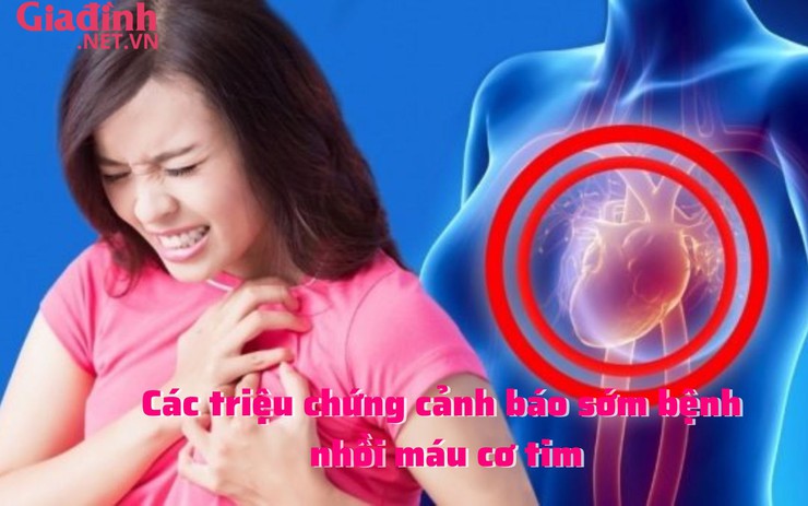Các triệu chứng cảnh báo sớm bệnh nhồi máu cơ tim
