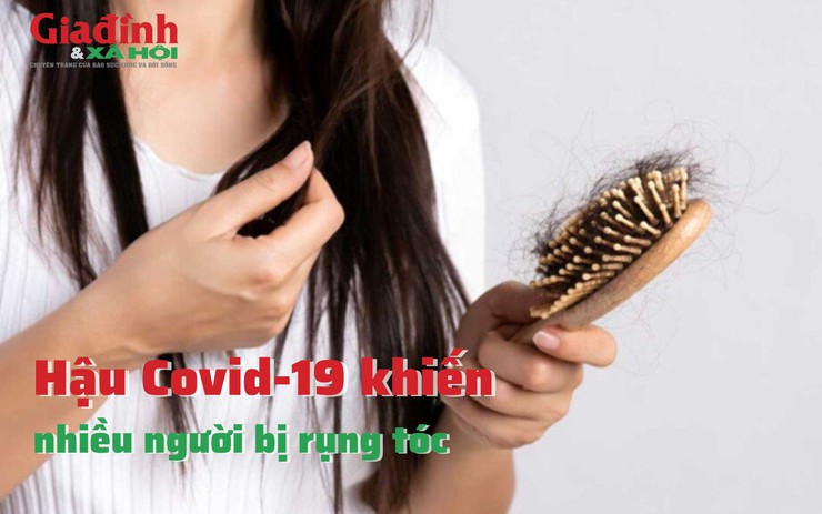 Hậu Covid-19 khiến nhiều người bị rụng tóc