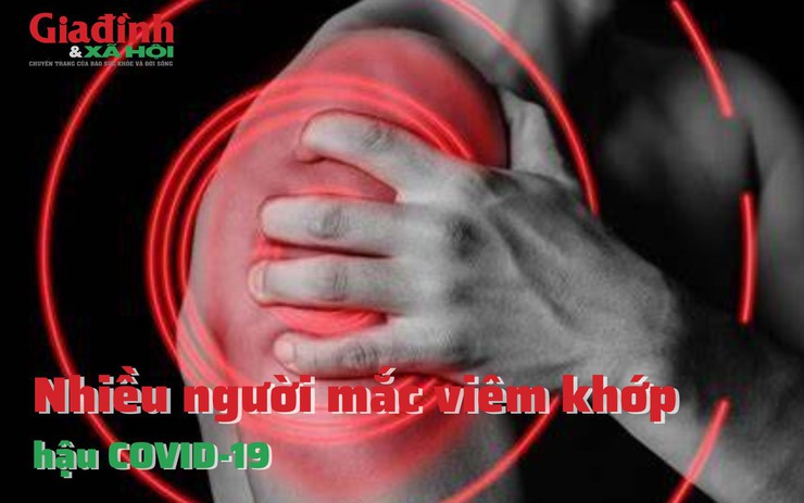 Nhiều người mắc viêm khớp hậu COVID-19